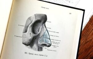 Read more about the article Jak optymalizować leczenie infekcji?